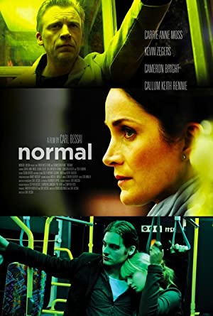 Normal izle